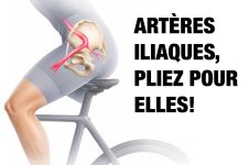arteres iliaques